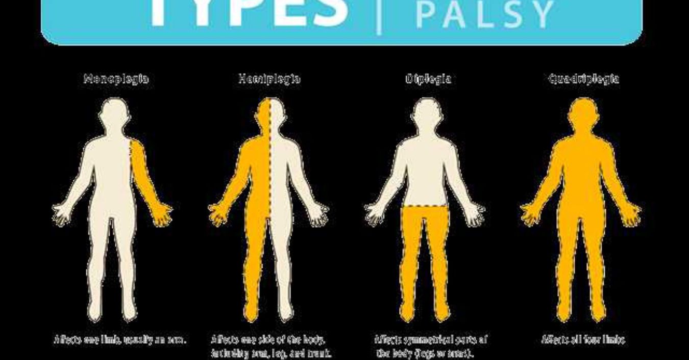 Cerebral Palsy Stem Cell Treatment India: A Ray of Hope for Patients